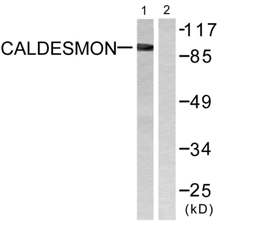 Polyclonal Rabbit anti-Human CALD1 / Caldesmon Antibody (p789, IHC, IF, WB)