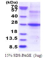 Human POMZP3 Protein (Recombinant His)