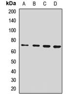 Polyclonal Rabbit anti-Human SLC11A2 / DMT1 Antibody (WB)