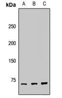 Polyclonal Rabbit anti-Human TRIOBP Antibody (WB)