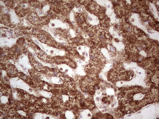 MTDH / Metadherin Antibody (aa70-582, clone OTI6H2)
