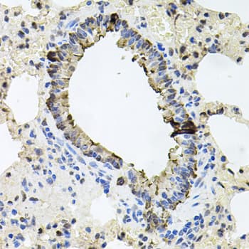 ERBB4 / HER4 Antibody