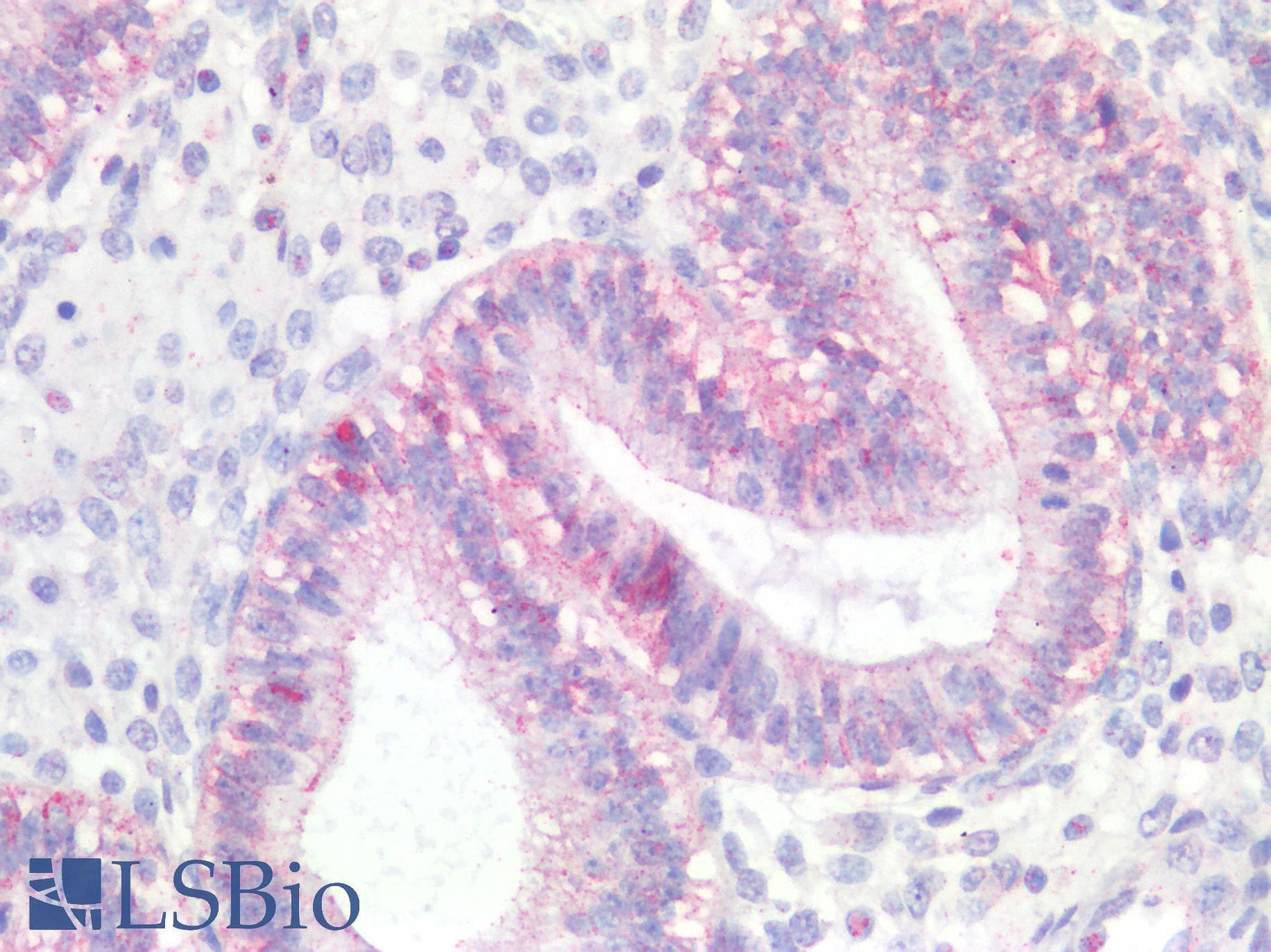 PathPlus™ CTNND1 / p120 Catenin Antibody