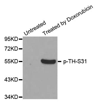 TH / Tyrosine Hydroxylase Antibody (phospho-Ser31)