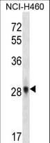 Polyclonal Rabbit anti-Human FGF10 Antibody (aa168-197, WB)