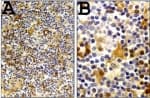 CASP1 / Caspase 1 Antibody (aa31-45)