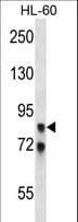 AKAP82 / AKAP4 Antibody (aa10-36)