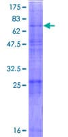 Human MBTPS2 Protein (Recombinant GST)