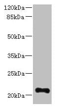 Polyclonal Rabbit anti-Human TTC9C Antibody (IHC, WB)