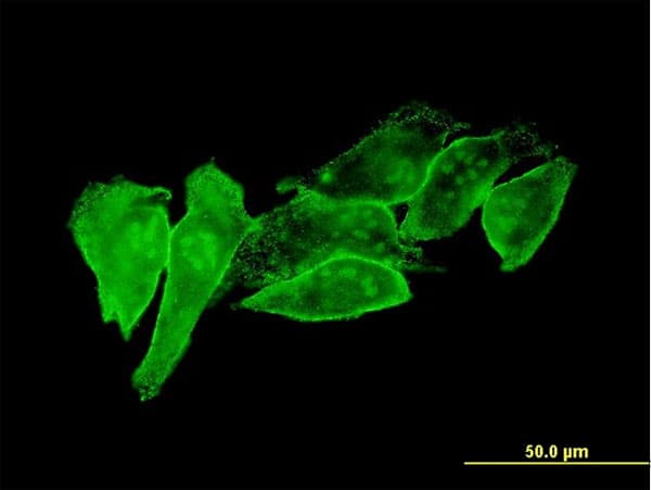 IHC-plus™ CYTH1 / Cytohesin-1 Antibody (clone 1D6)