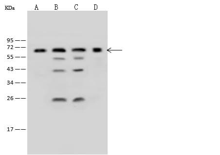 ME2 / Malate Dehydrogenase 2 Antibody (Preservative Free)