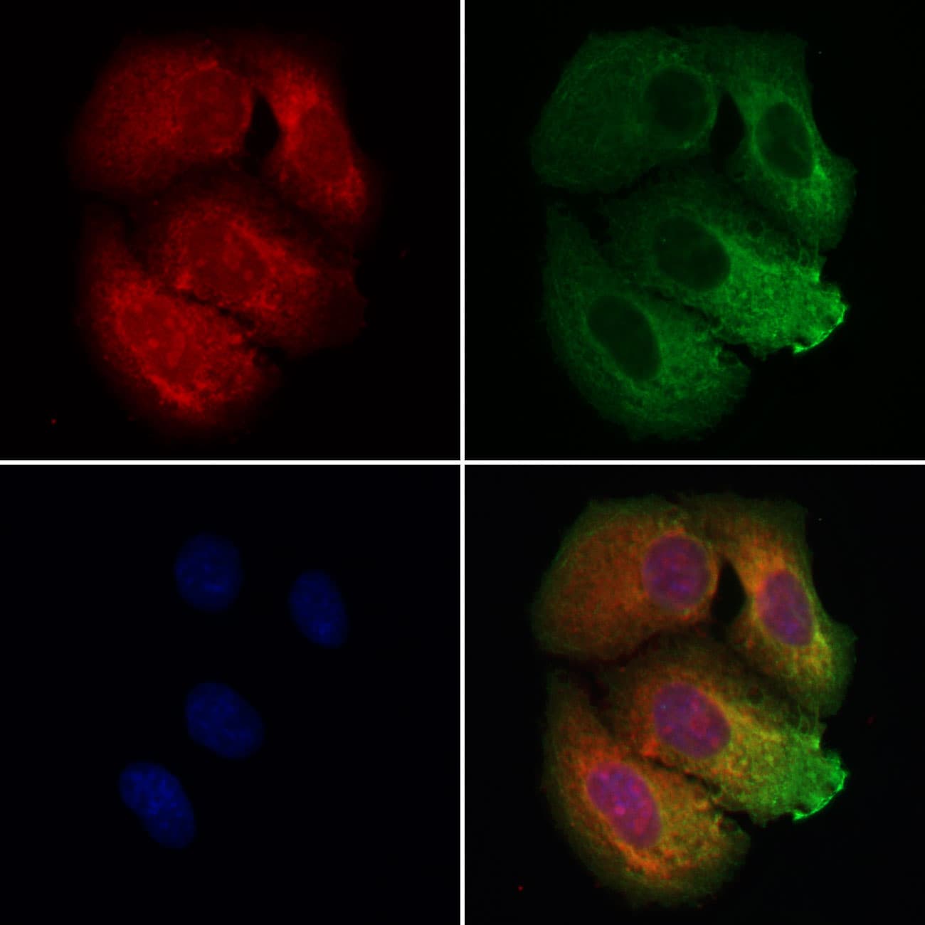 BBS9 Antibody