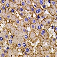 Polyclonal Rabbit anti-Human AP2A2 Antibody (IHC, WB)
