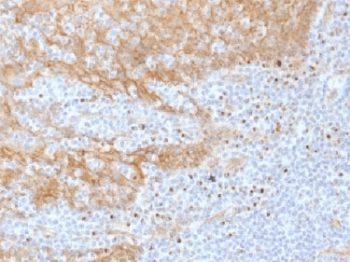 Monoclonal Mouse anti-Human CTNNB1 / Beta Catenin Antibody (clone CTNNB1/1508, IHC, IF, WB)