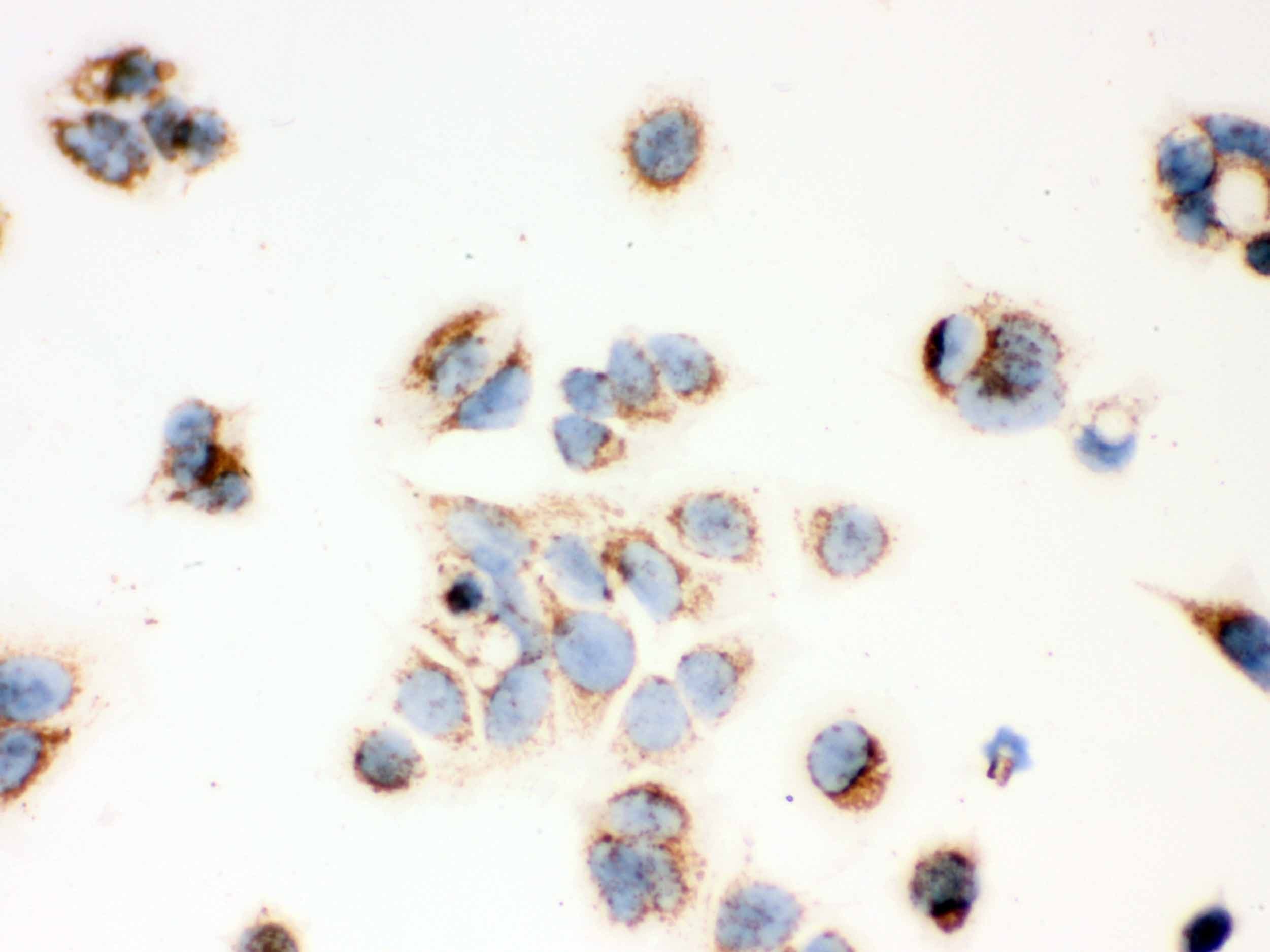 HSD17B10 / HADH2 Antibody (aa48-261)