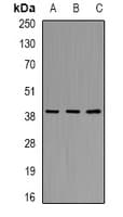 AKR7A2 / AFAR Antibody