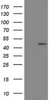SLFNL1 Antibody (clone OTI1C4)