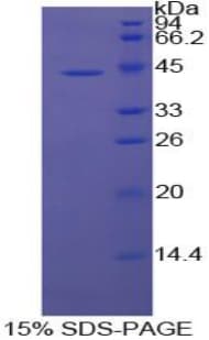 Bovine CCL4 / MIP-1 Beta Protein (Recombinant His-GST)