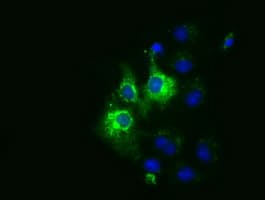CYB5R3 / B5R Antibody (clone OTI1E3)