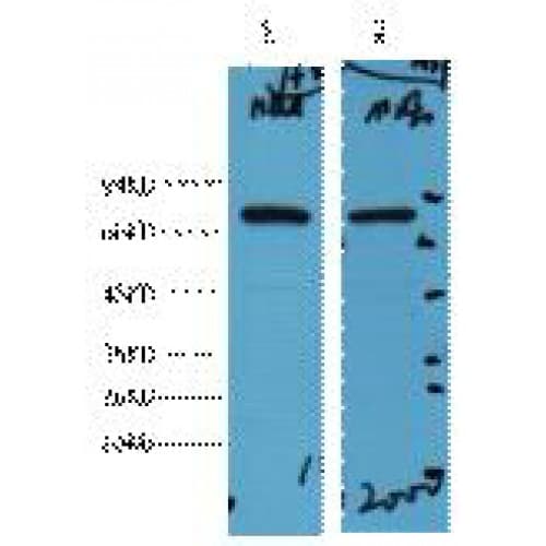 HSP70 / Heat Shock Protein 70 Antibody (clone 3G10)