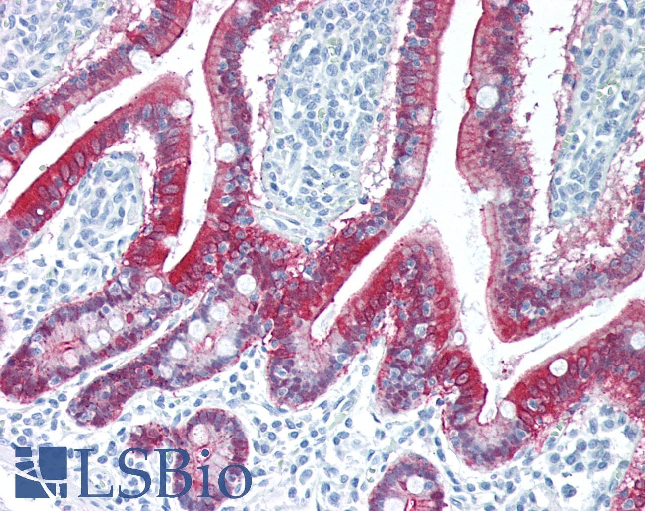 PathPlus™ VIL1 / Villin Antibody