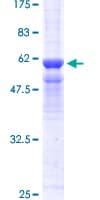 Human PPP4C Protein (Recombinant GST)
