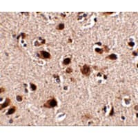 SLITRK5 Antibody