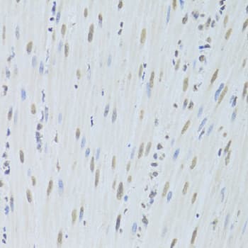 Polyclonal Rabbit anti-Human HNRNPK / hnRNP K Antibody (IHC, IF, WB)