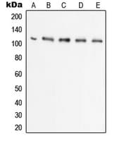 Polyclonal Rabbit anti-Human UBE1L / UBA7 Antibody (C-Terminus, IHC, WB)