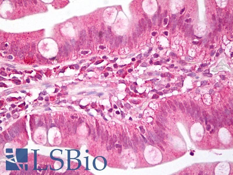 IHC-plus™ Polyclonal Rabbit anti-Human MEIS1 Antibody (aa280-330, IHC)