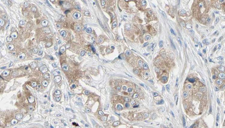 RPL18A Antibody