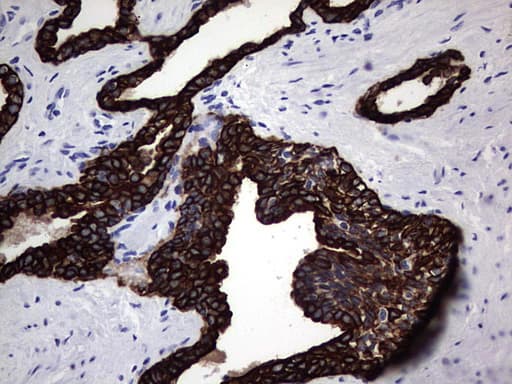 IHC-plus™ Acidic Cytokeratin Antibody (clone 1D10)