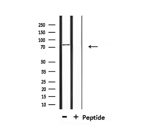TGM2 / Transglutaminase 2 Antibody