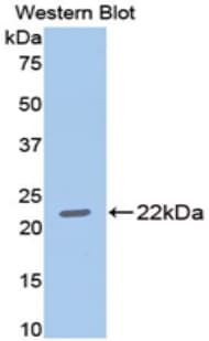 MMP13 Antibody (aa280-455, Biotin)