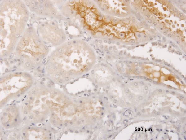 S100A5 Antibody (clone 5E1)