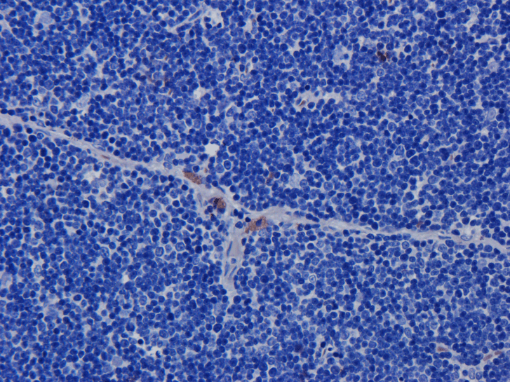 CD52 Antibody (CD52, clone Campath-1H)