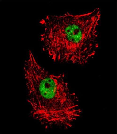 FUS / TLS Antibody (aa499-526)