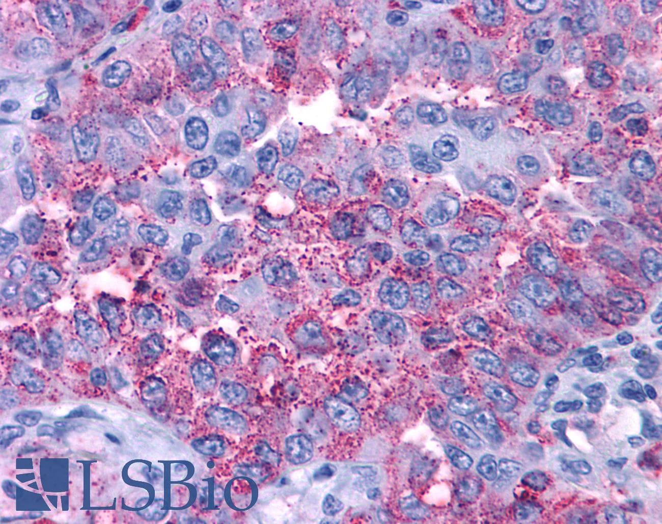 IHC-plus™ Polyclonal Rabbit anti-Human P2RY4 / P2Y4 Antibody (Cytoplasmic Domain, IHC)