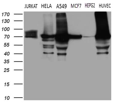 TGM2 / Transglutaminase 2 Antibody (clone OTI2F9)