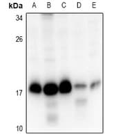 RPS15 / Ribosomal Protein S15 Antibody