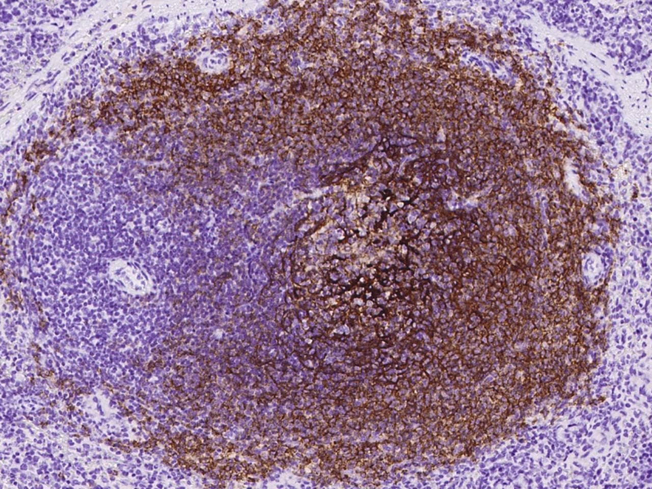 Monoclonal Mouse anti-Human CR2 / CD21 Antibody (clone 28, Preservative Free, IHC)