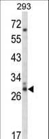 CDC42EP3 Antibody (aa1-30)