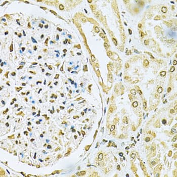 HNRNPA2B1 Antibody