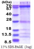 Human ZWILCH Protein (Recombinant His)