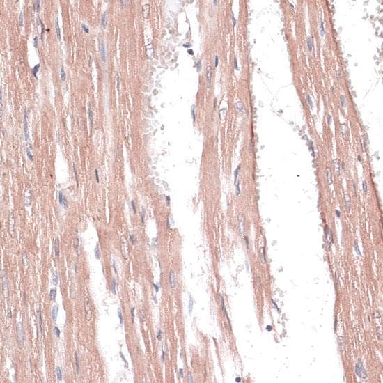 COL11A1 / Collagen XI Alpha 1 Antibody