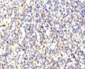 ACP5 / TRAP Antibody (clone HACP5-1)