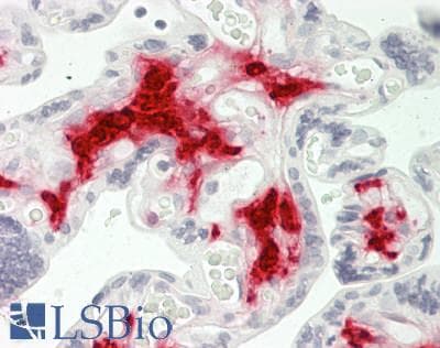 PathPlus™ F13A1 / Factor XIIIa Antibody (clone 1H2)