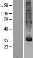 Human MFSD5 Protein (Over-Expression Lysate Myc-DDK (Flag))