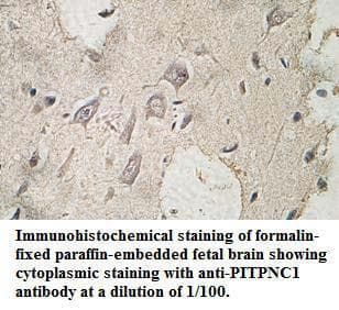 Polyclonal Rabbit anti-Human PITPNC1 Antibody (aa12-258, IHC, WB)