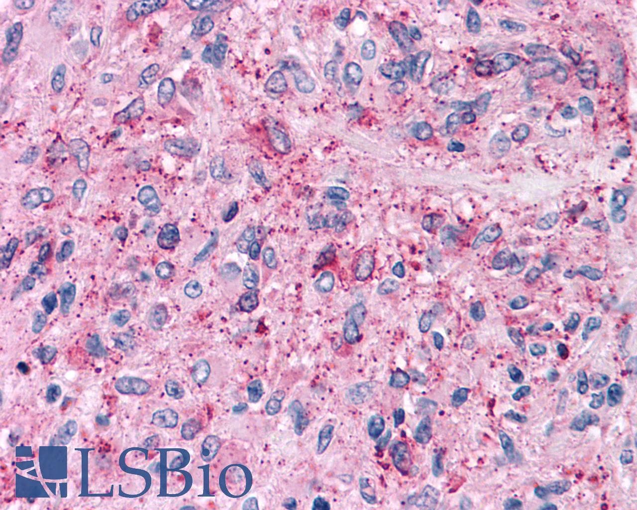 PathPlus™ NPY5R Antibody (Cytoplasmic Domain)